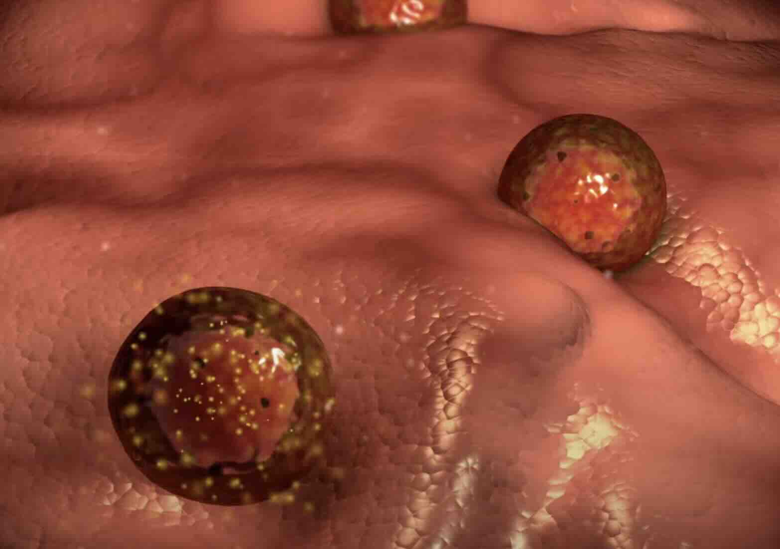 Adet Döngüsü, Gecikmesi, Şiddetli Adet Ağrısı ve Düzensizlikleri