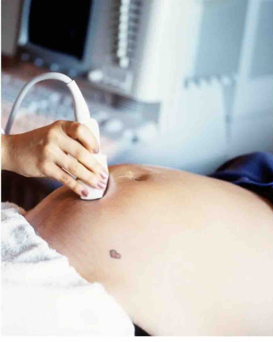 AMNİYON SIVISININ FAZLA OLMASI (POLİHİDRAMNİYOS)