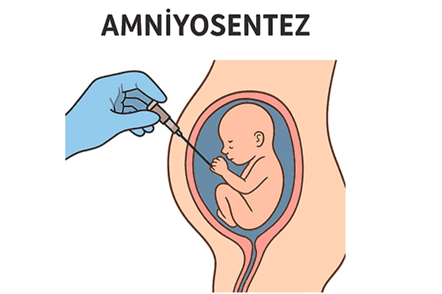 Amniyosentez Zararlı mı? Amniyosentez Düşüğe Neden Olur mu?
