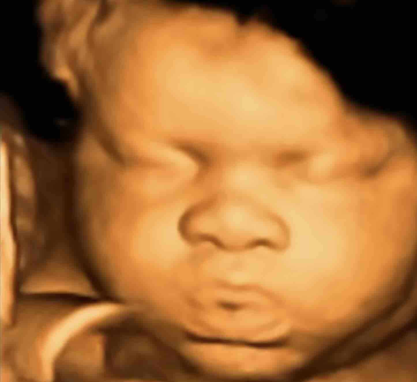 Ankara Ayrıntılı Ultrason