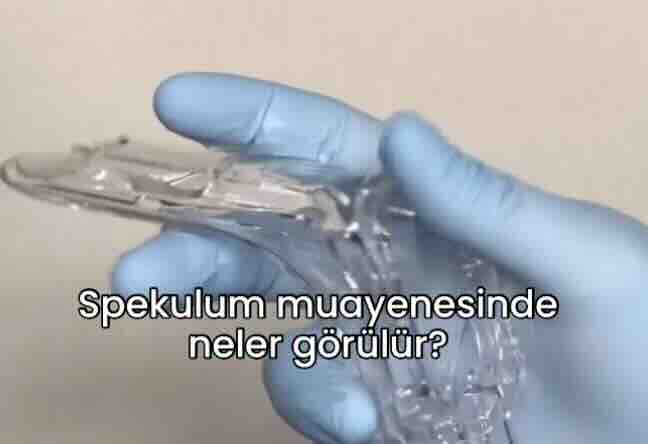 Ankara Kadın Doğum Doktoru