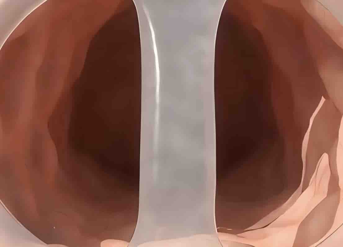 Ankara Labioplasti Fiyatları 2026