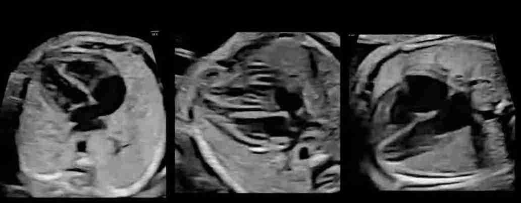 Ankara Perinatoloji Uzmanı ile Fetal Ekokardiyografi: Bebeğinizin Kalp Sağlığı Güvenilir Ellerde