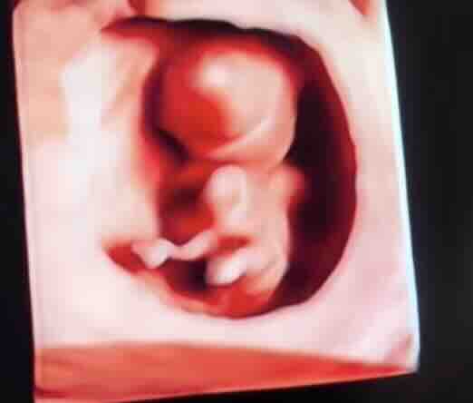 Ankara Perinatoloji Uzmanı