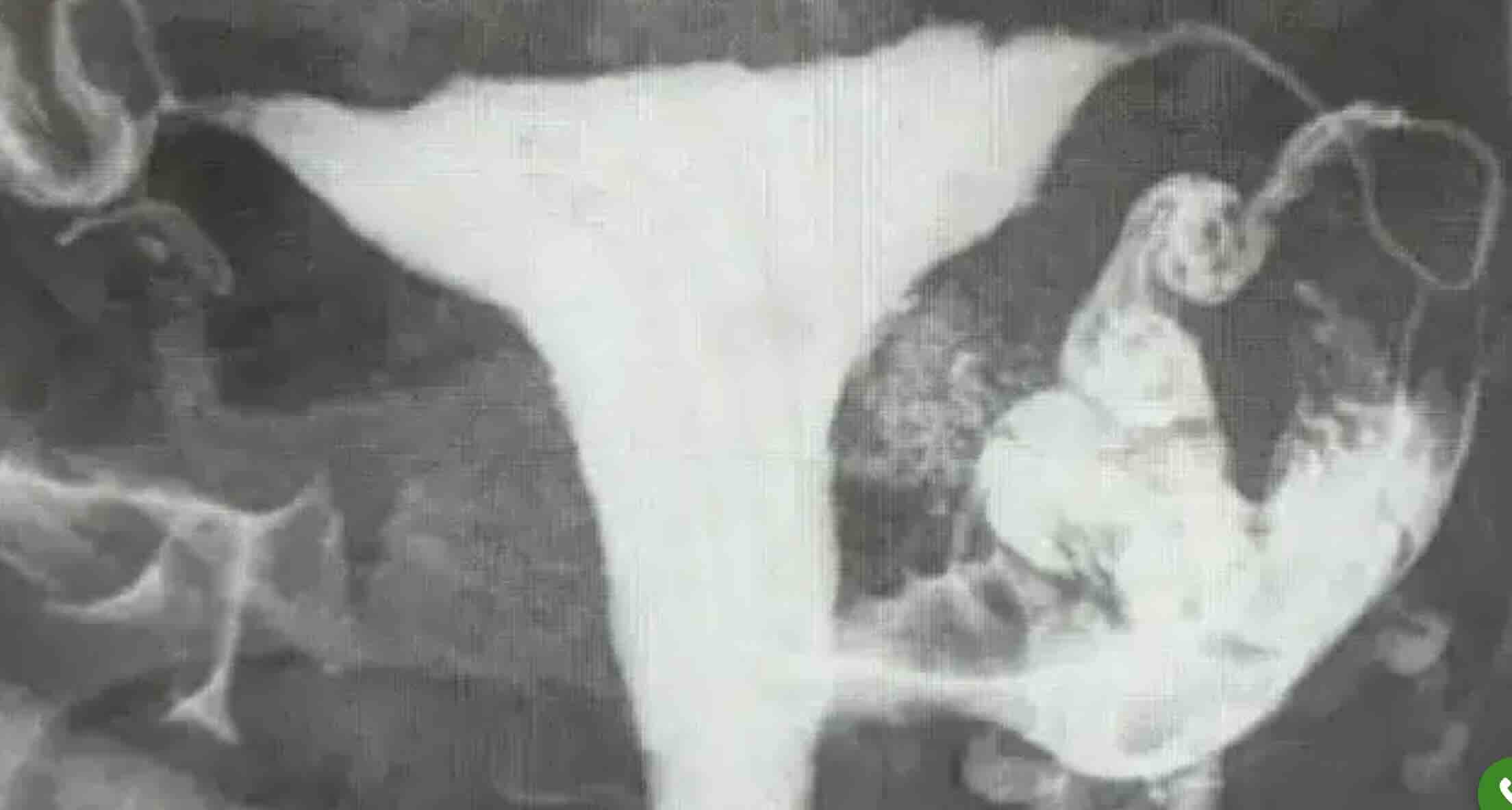 Ankara Rahim Filmi Ücretleri 2026