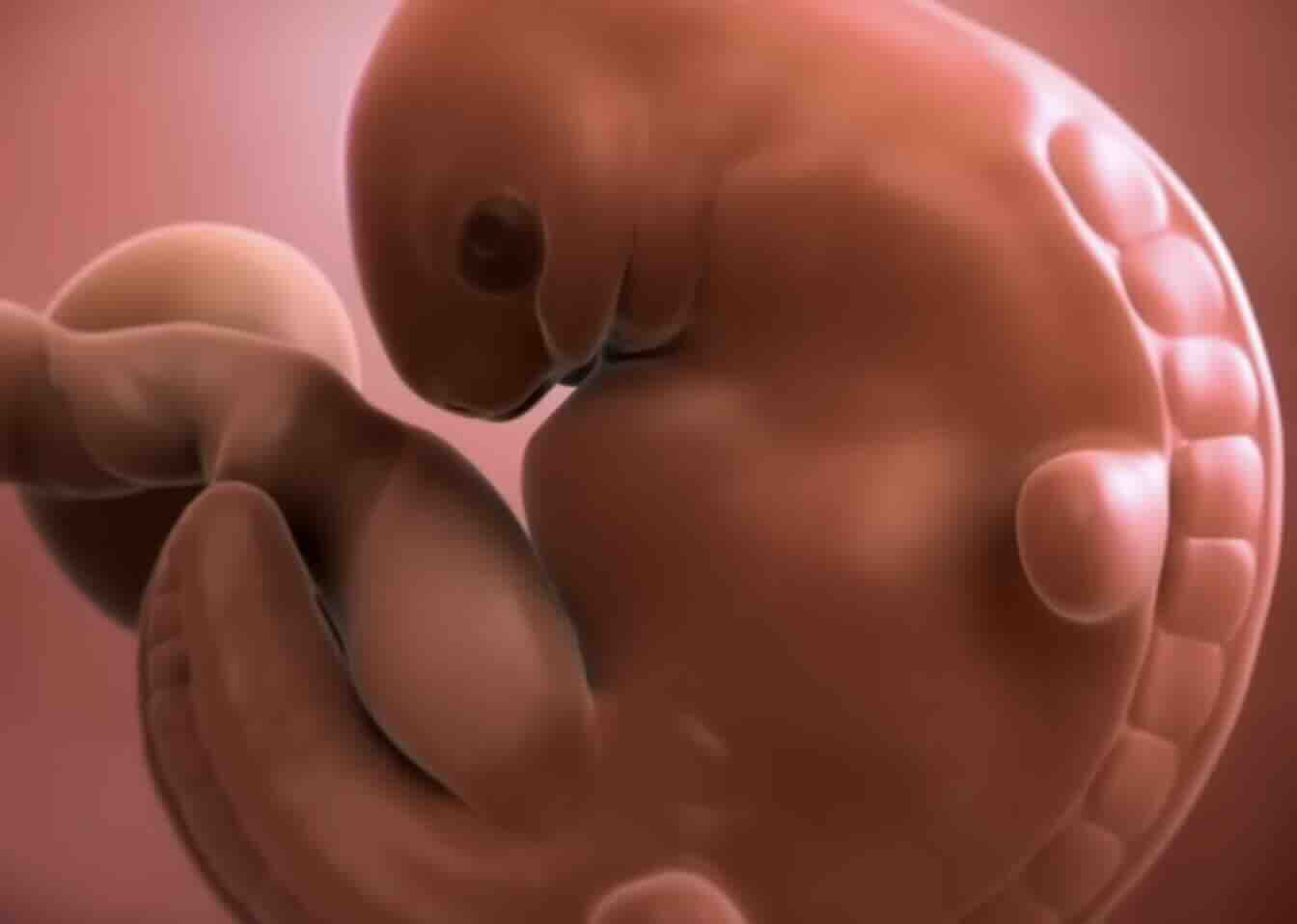 Ankara Riskli Gebelik