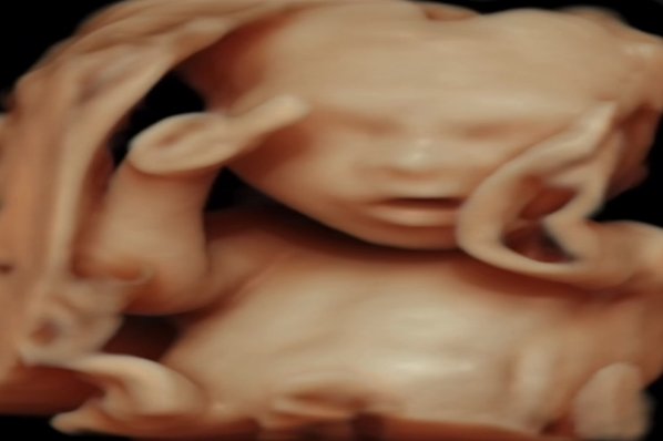 Ayrıntılı Ultrason