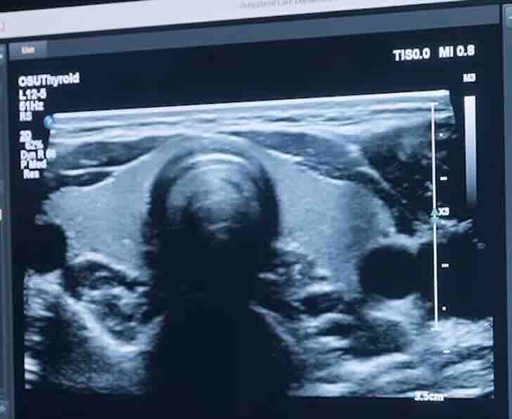 Ayrıntılı Ultrasonu Radyolog mu Perinatolog mu Yapar?