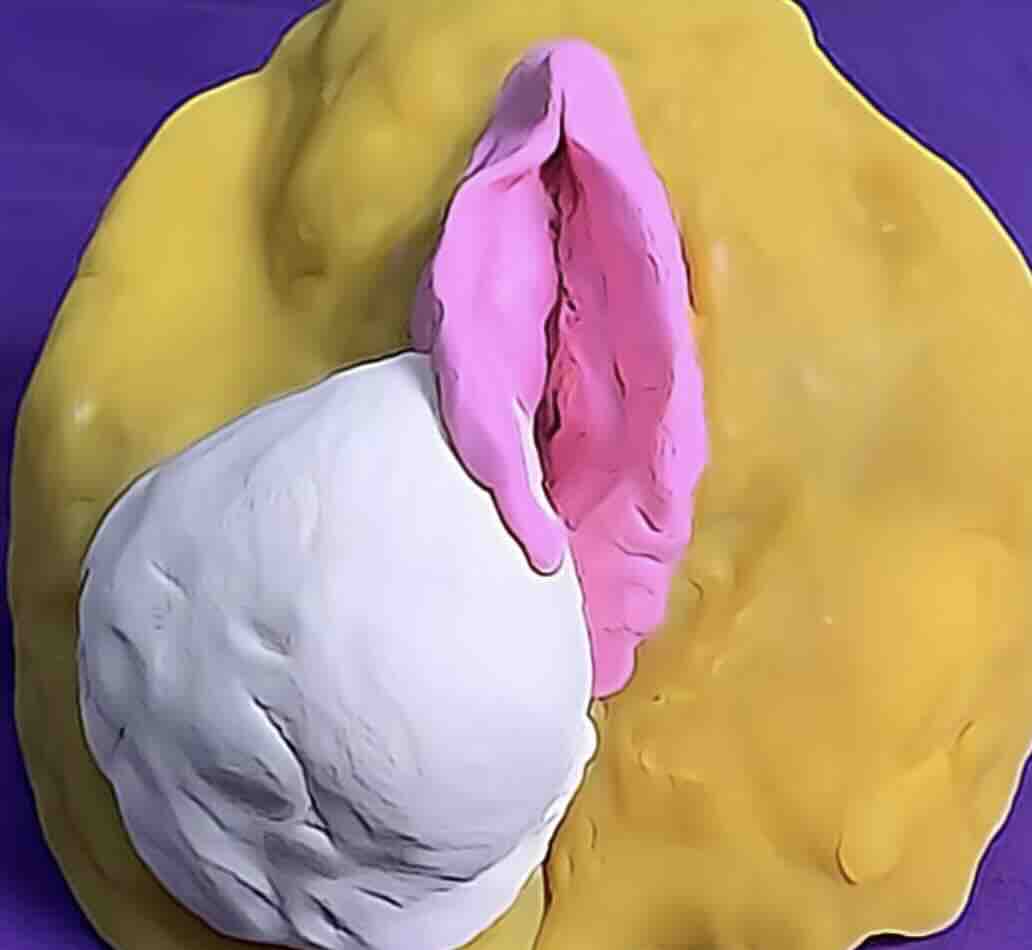 Bartholin Kisti