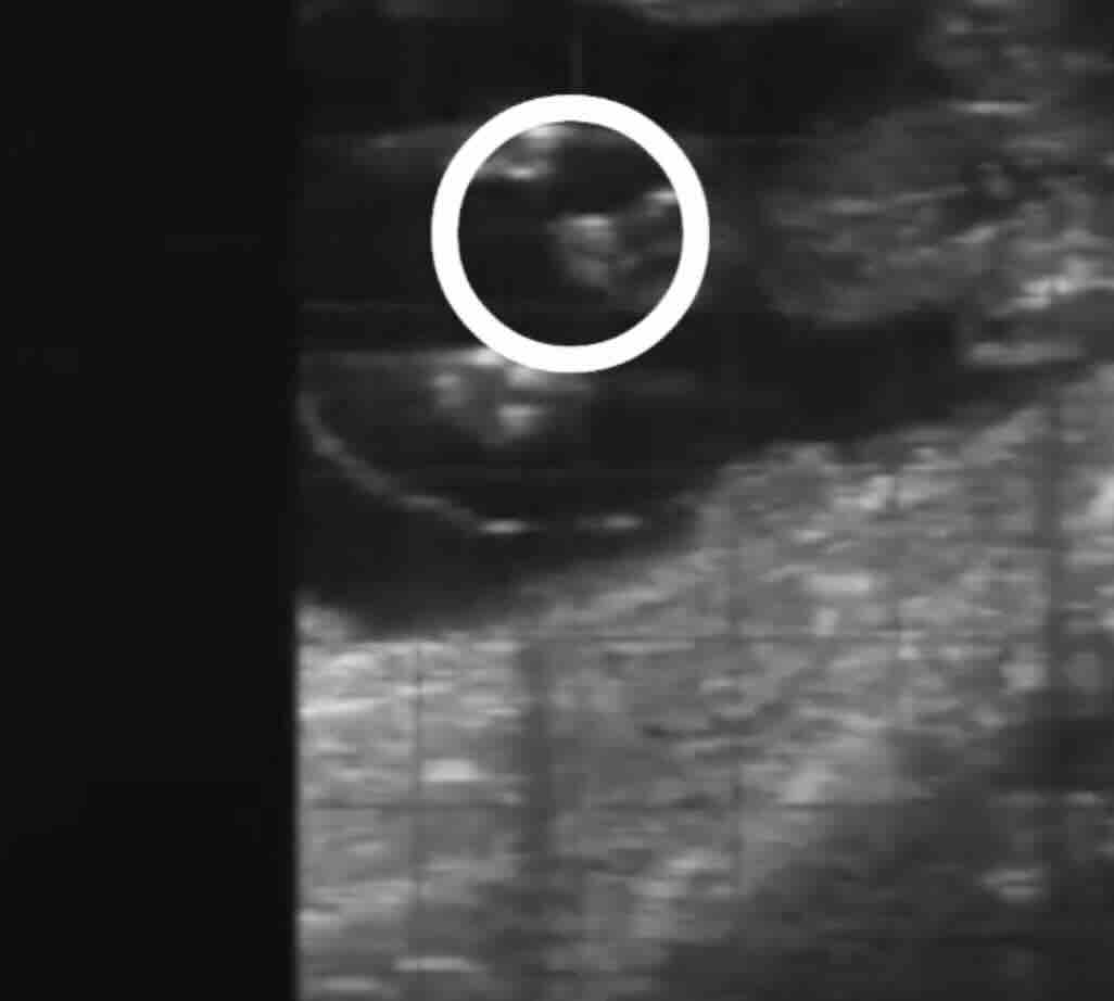 Bebek Cinsiyeti Belirleme Yöntemleri