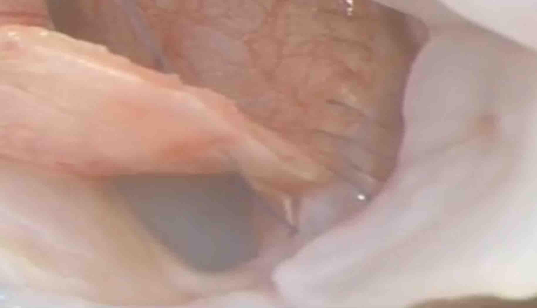 Bebek Kalp Delikleri (VSD): Neden Olur, Nasıl Anlaşılır, Nasıl Tedavi Edilir?