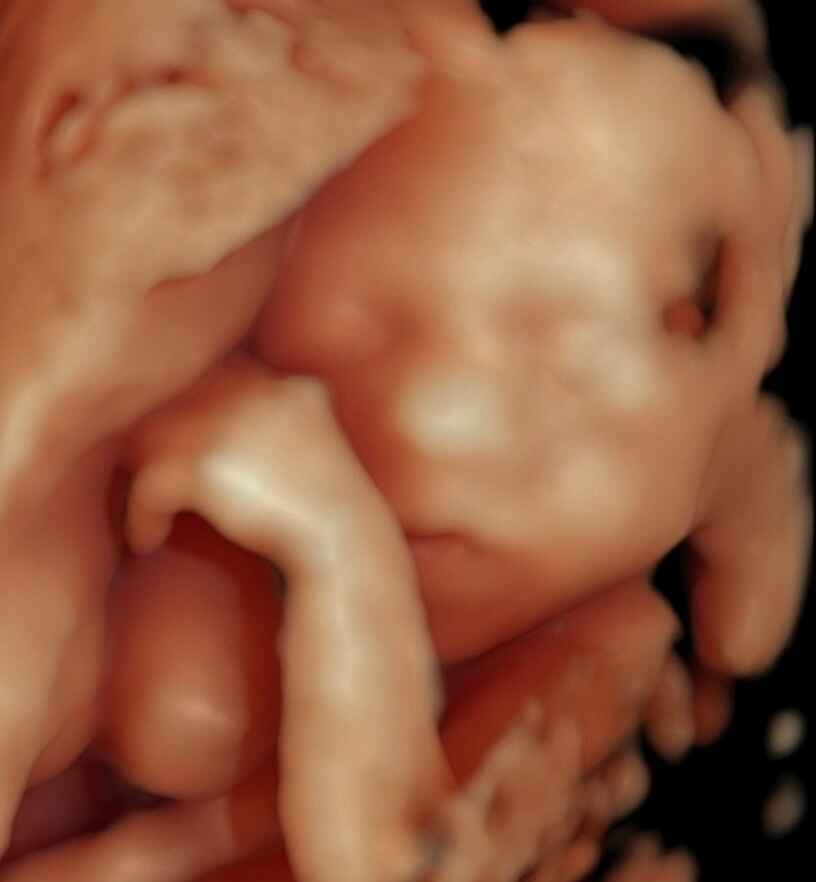 Detaylı (Ayrıntılı) Ultrason Ankara 2026 Ücretleri