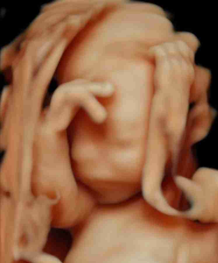 Detaylı Ultrason Nedir? Ankara’da Detaylı Ultrason Nasıl Yapılır, Nelere Bakılır?