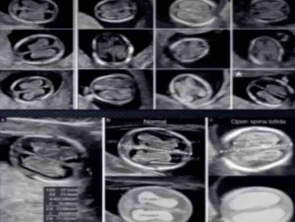 Detaylı Ultrasonda Hangi Organlara Bakılır?