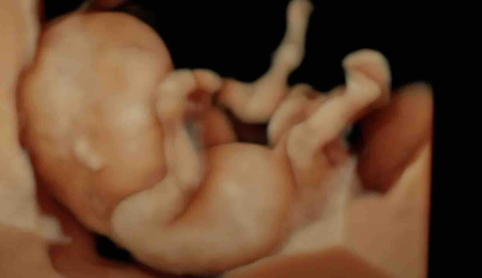 ERKEN DETAYLI ULTRASON (11–14 HAFTA ULTRASONU) – ANKARA PERİNATOLOJİ