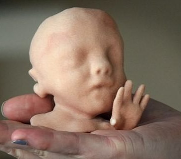 Fetal Anomali Taraması
