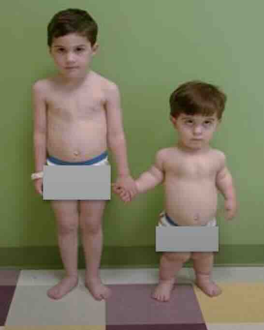 Fetal İskelet Displazileri: Bebeğinizin Kemik Gelişimindeki Gizemler