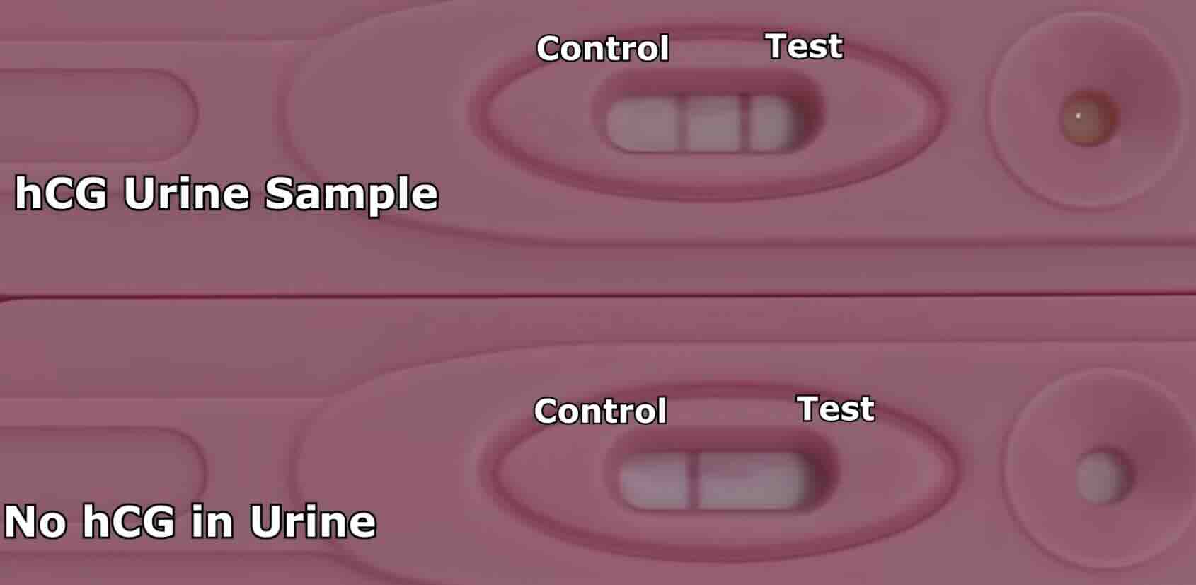 Gebelik İçin İdrar Testi Nedir? Ne Zaman Yapılır?