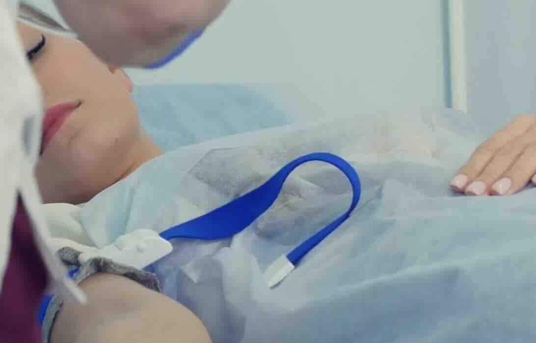 Gebelikte Anemi ve Demir Takviyesi