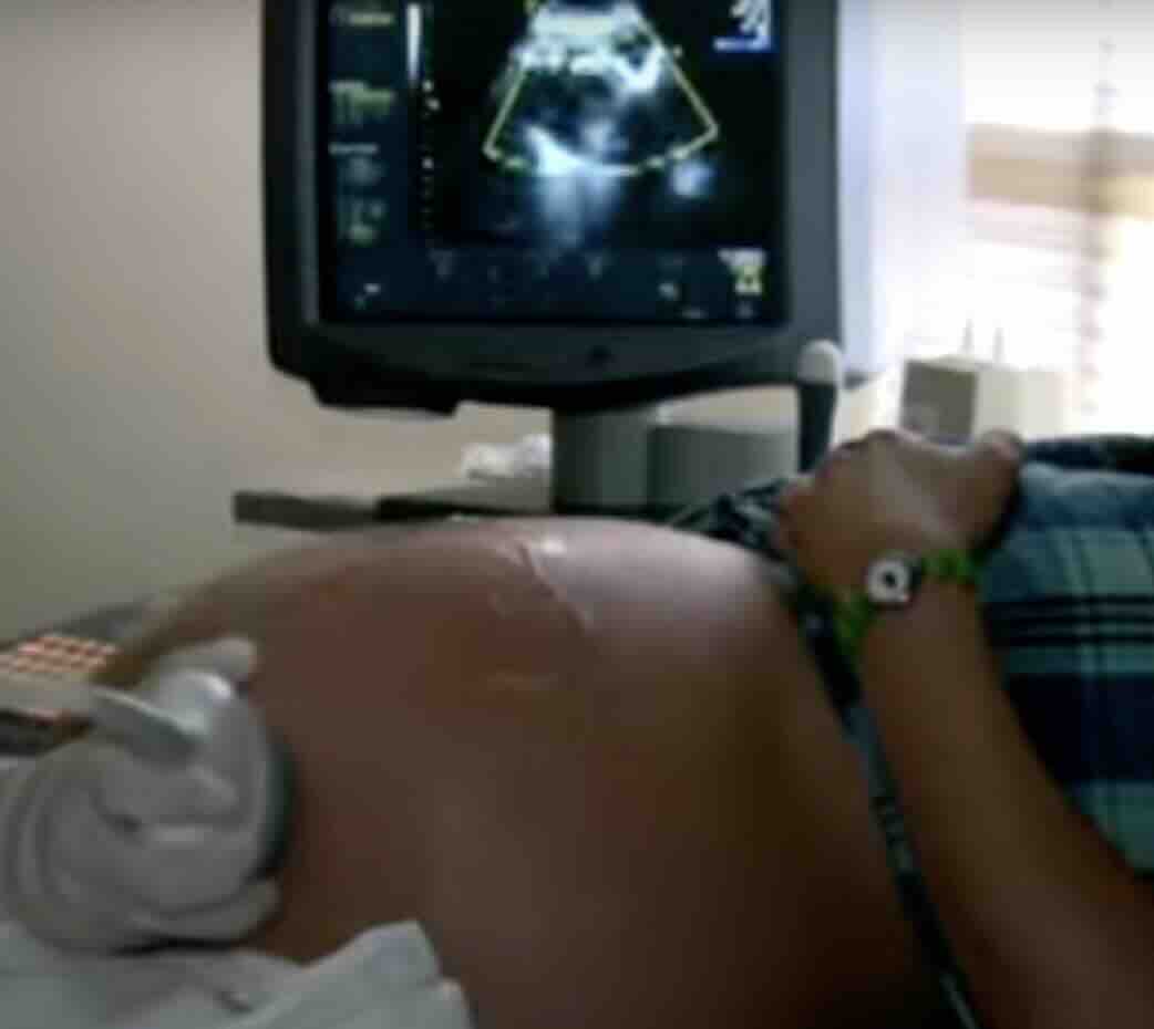 GEBELİKTE KAN UYUŞMAZLIĞI (RH UYUŞMAZLIĞI) – ANNE ADAYLARI İÇİN EN DETAYLI REHBER