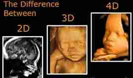 Gebelikte Renkli Ultrason ve 3D–4D (Boyutlu) Ultrason Ücretleri Ankara 2026