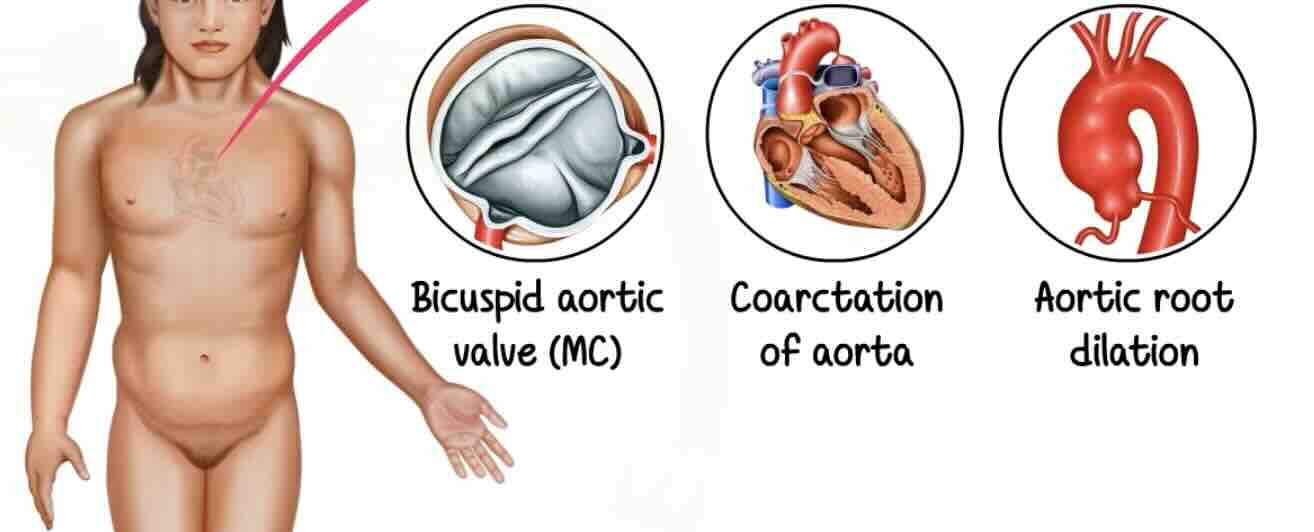 Gebelikte Turner Sendromu: Bulgular, Belirtiler, Tanı ve Yönetim Rehberi