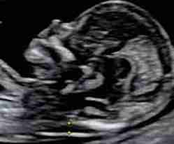 İkili Üçlü  dörtlü Test