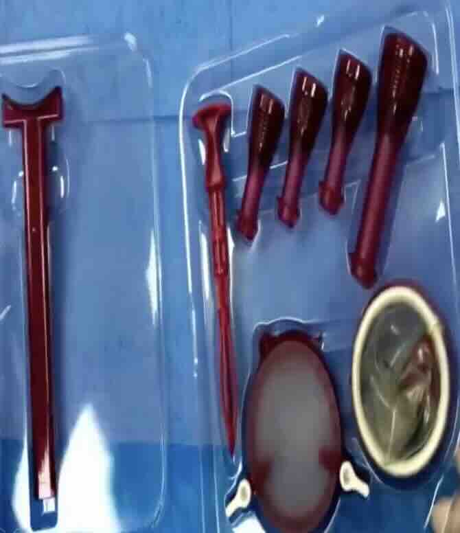 Kadın Doğum İzsiz Ameliyat (V-NOTES) Nedir?