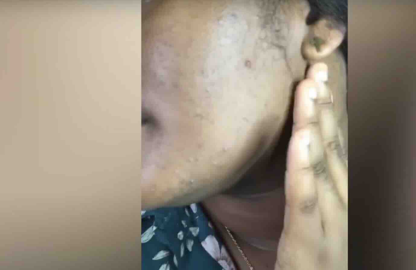 Kadınlarda Hormonal Düzensizlikler: Nedenleri, Belirtileri ve Tedavisi