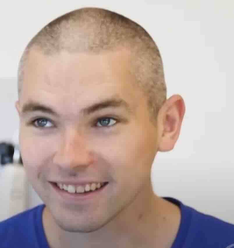 Otizm ve Gebelik: Anne Karnındaki Riskler, Bilimsel Gerçekler ve Doğru Bilinen Yanlışlar