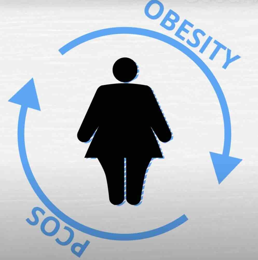 POLİKİSTİK OVER SENDROMUNDA (PCOS) NASIL KİLO VERİLİR?