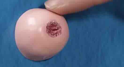 Rahim Ağzı (Serviks) Kanseri Nedir? Belirtileri, HPV İlişkisi, Aşı, Tarama ve Tedavi 