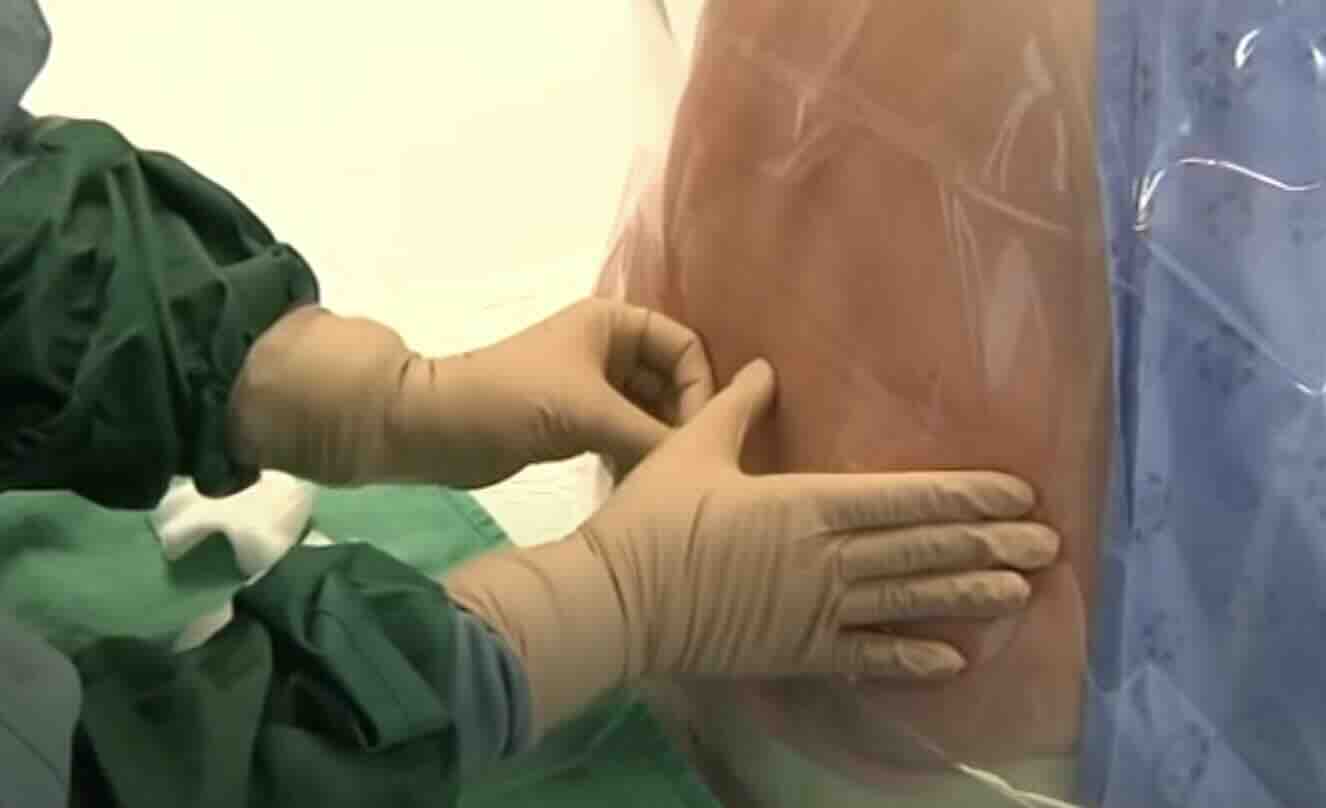 Spinal ve Epidural Sonrası (Belden İğne) Bel, Bacak ve Baş Ağrıları