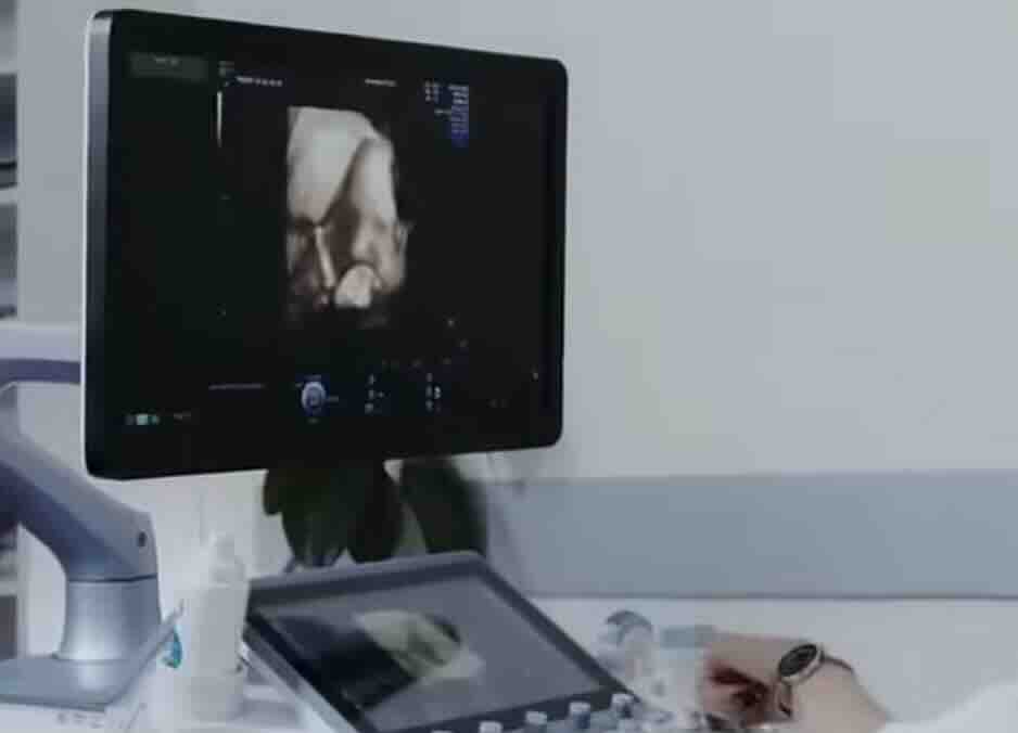 Tekrarlayan Düşükler