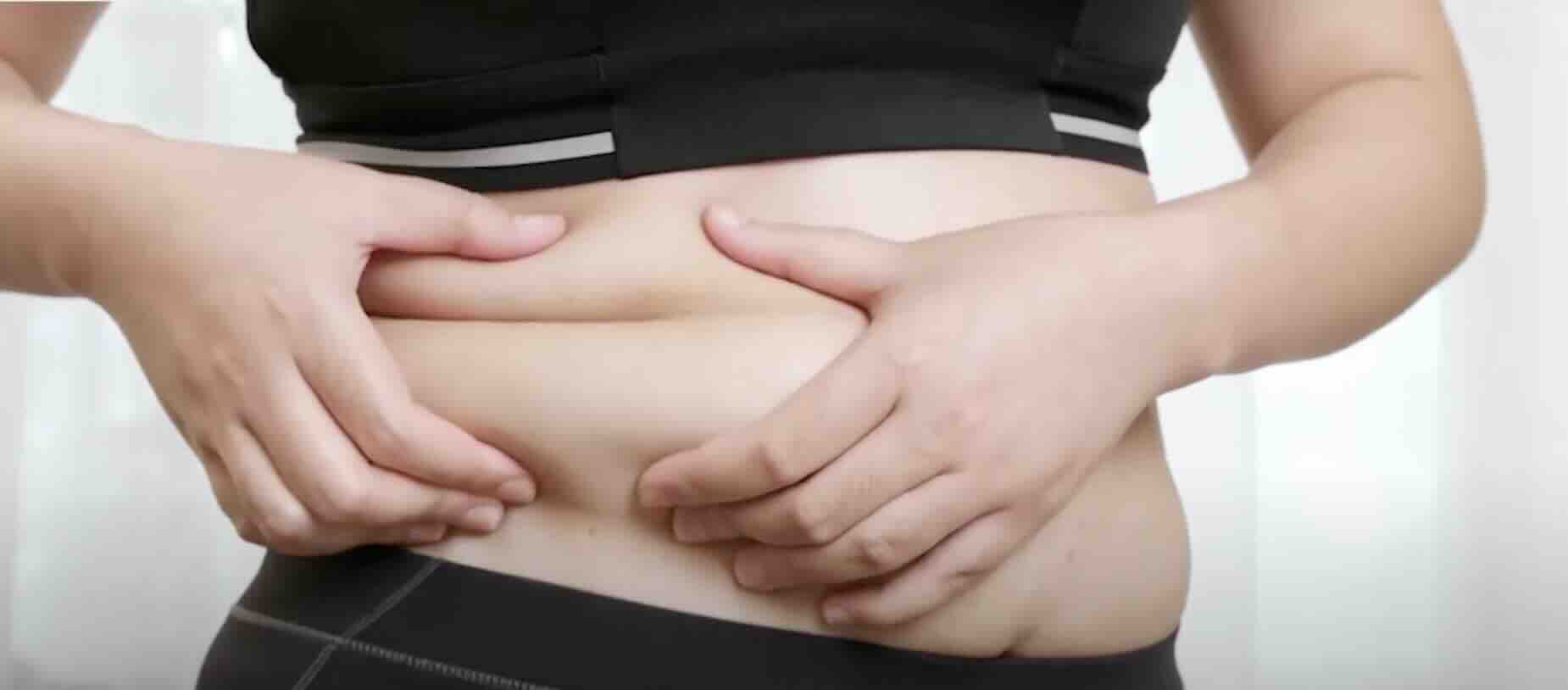 Venüs Tepesi Estetiği (Monsplasti)