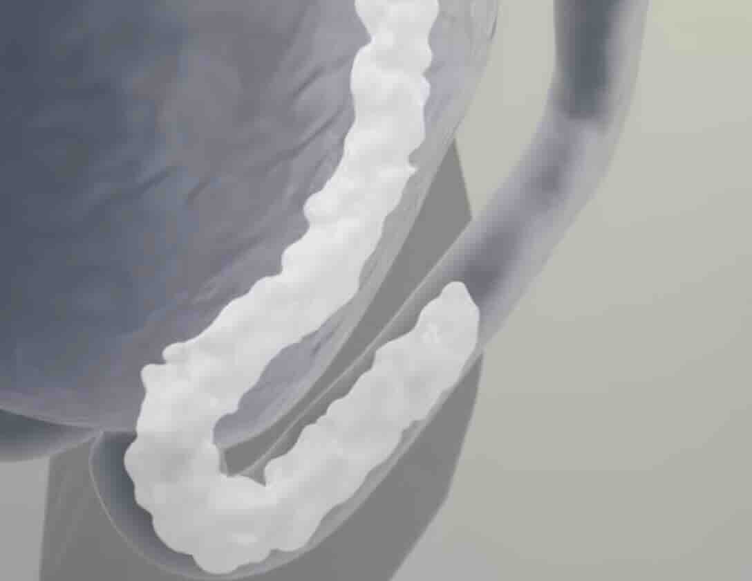 Zevk Suyundan (Pre-ejakülat) Hamile Kalınır mı?